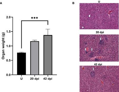 Leishmania infection-derived extracellular vesicles drive transcription of genes involved in M2 polarization